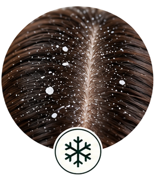 Dandruff & Flakes